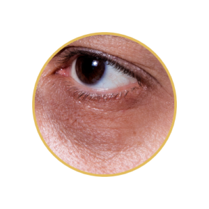 Dark Circle